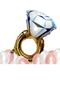 Solitaire Ring Gold Colored Diamond Foil Balloon Gold Yellow Bachelorette Party Bride to Be 70X45 cm - 6