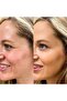 Face Lift Tape - Face Lift (Coffee) Eyebrow Lift Cat Eye Coffee Color - Botox Effect Eyebrow Lift - 3