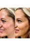Botox Buckle Face Lift Brown Color Eyebrow Lift Cat Eye - 2