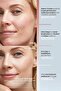 Anew Sensitive - حزمة خاصة للبشرة الحساسة - 5