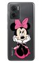 Xiaomi Redmi Note 11E Case 0.4mm Silicone Patterned Minnie Character