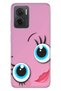 Xiaomi Redmi Note 11E Case 0.4mm Silicone Patterned Lovingly