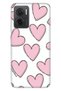 Case for Xiaomi Redmi Note 11E 0.4mm Silicone Patterned Pink Stripes Hearts
