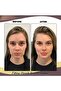 Black Color Eyebrow Lifting Buckle - Botox Clasp - Ultra Strong Grip - Double Band - 2