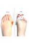 Metatarsal Pad - Fits to the Middle Finger - 6
