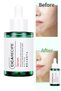 Anti-Soothing Serum Containing Cica Centella – Special Care for Sensitive Skin