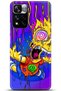 Xiaomi Redmi Note 11 Pro Plus 5g Case Hd Printed Case - Followed Institution 0158