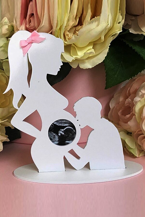 UTKU TASARIM Linda Ahşap Ultrason Görüntüsü Resim Çerçevesi Ilk Fotoğrafım Çerçevesi Beyaz