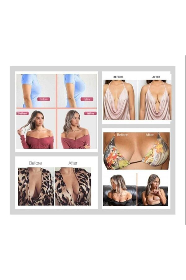 BEAUTY BOX COSMETIC-5Cm*5M Skin Color Water Resistant Chest Tape - Boob Tape Kinesiology Tape 1