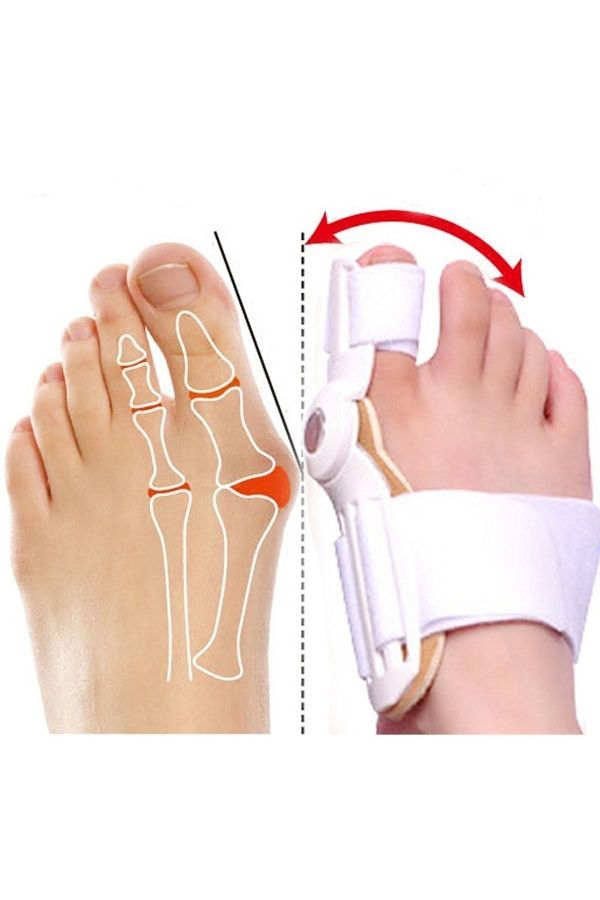 Reidan-Orthopedics Foot Corrector - Big Toe and Bone Adjuster, Correction Foot Separator 1