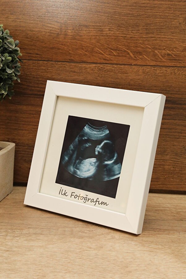 Aksesuar ZD Store İlk Fotoğrafım Bebek Ultrason Çerçevesi Beyaz