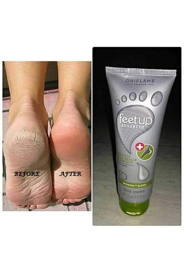 Oriflame feet up advanced cracked heel repair top