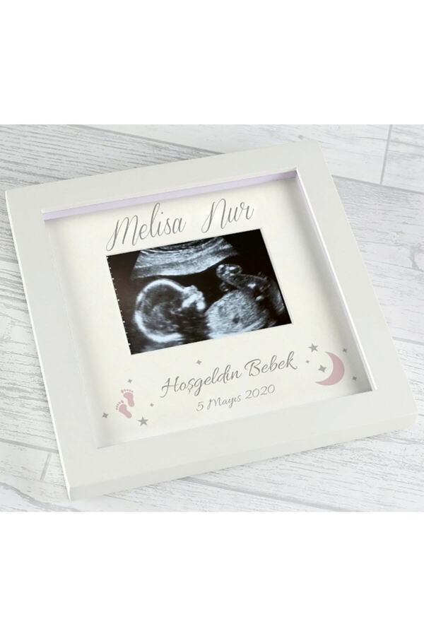 zuzupix Yeni Doğan Özel Bebek Fotoğraflı Ve Özel Notlu Anı Çerçevesi