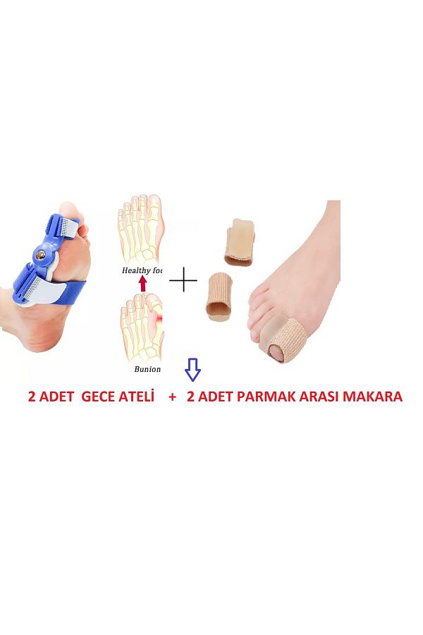 başarı ortopedi-Bunion Correction System - Hallux Valgus Soft Support Orthopedic 1
