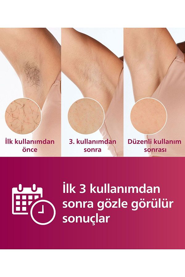 Philips Sc1997/00 Lumea Lazer Epilasyon Ipl Tüy Alma Cihazı,çanta Hediyeli,ekstra Uzun Kablo - Görsel 2