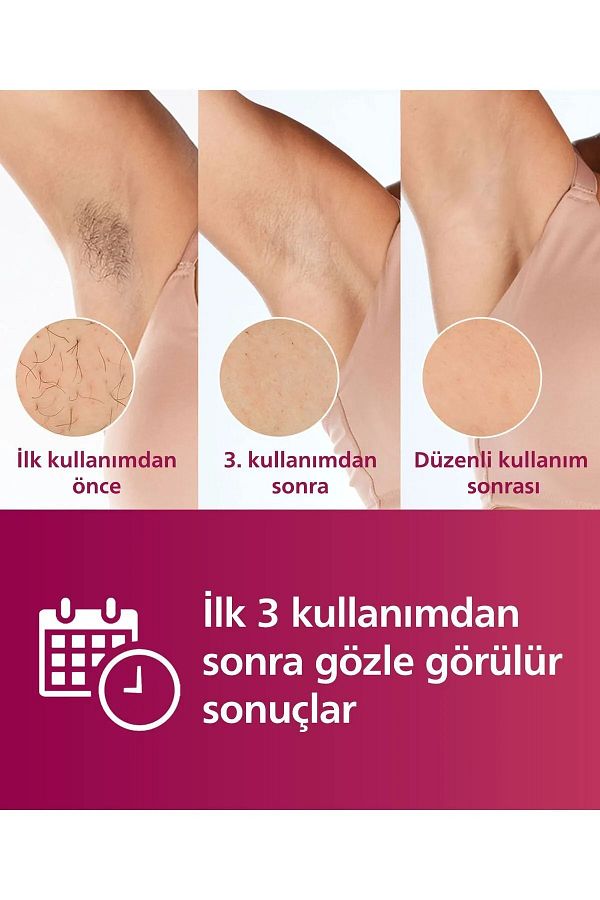 Philips Yeni Lumea Ipl Tüy Alma Senseıq Teknoloji 2 Başlıklı ( Yüz & Vücut ) Premium Lazer Epilasyon Seti - Görsel 5