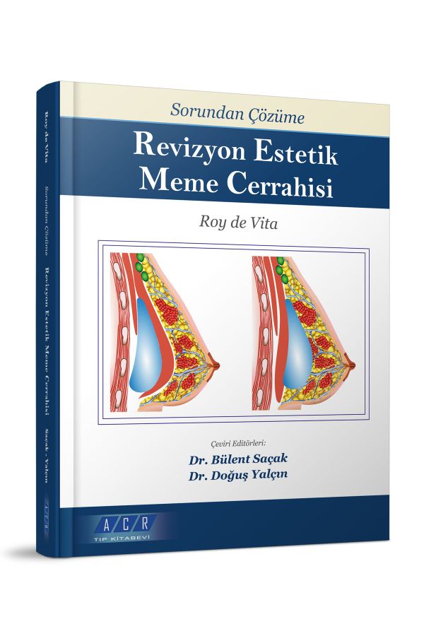 Sorundan, Çözüme Revizyon Estetik Meme Cerrahisi