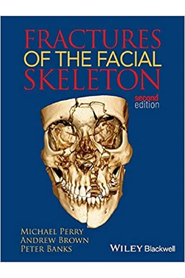 Fractures Of The Facial Skeleton, 2nd Edition 2nd Edition Kongre Tıp Kitabevi