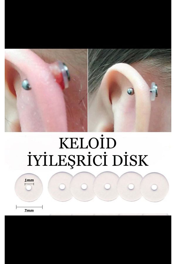 Bioplast Silikon Keloid Iyileştirici Ve Önleyici Anti Hiperplazi Için Disk