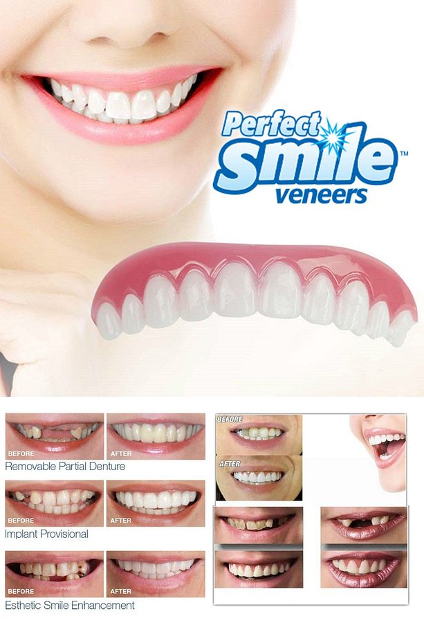 Perfect Smile Takma Diş Mükemmel Gülüş Tak Kullan Gülümse Diş Takma Gülüş Beyaz Diş - 1