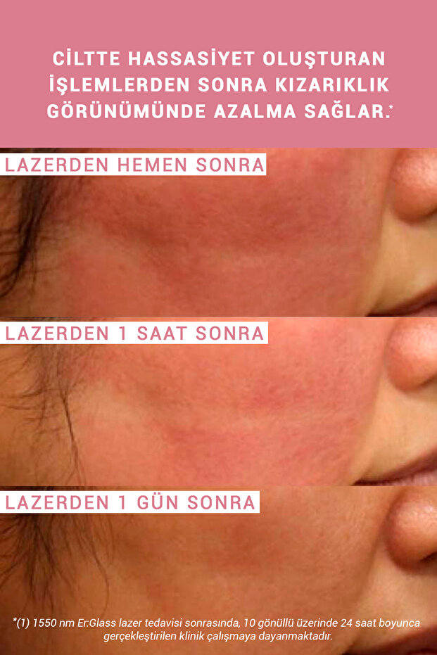 Pure Active Enoxolone Hassas ve Rozalı Ciltler İçin Kızarıklık Karşıtı Saf Cilt Serumu 15 ML - 9