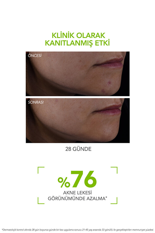 Sebium Serum 30 ml - 3