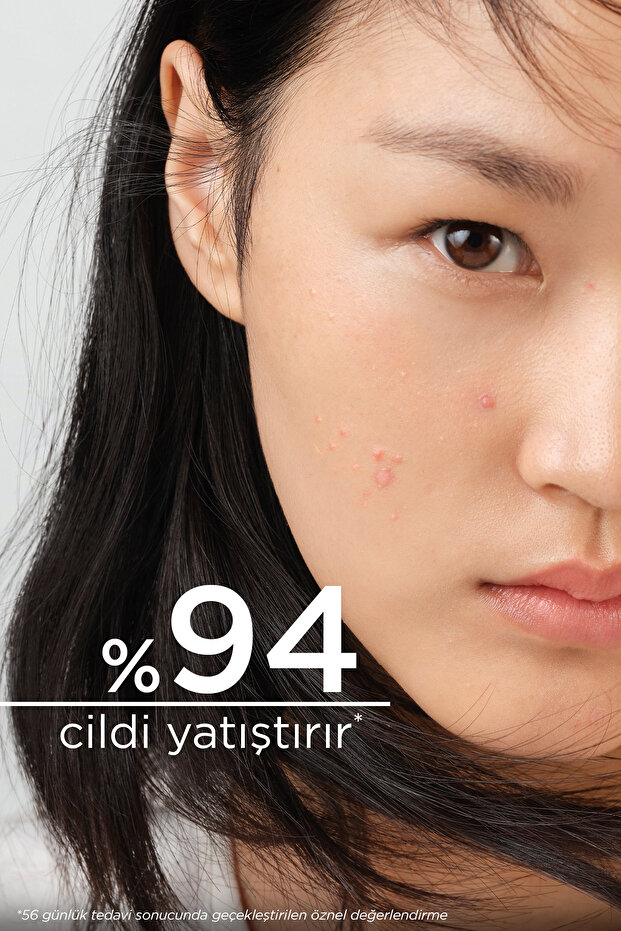 Sebium Sensitive Karma, Yağlı ve Akne Eğilimli Ciltler Yatıştırıcı Nemlendirici Bakım Kremi 30 ml - 5