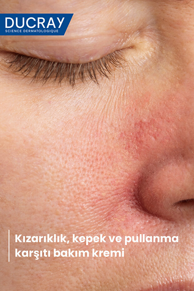Kelual DS Cilt Pullanmalarına Karşı Yatıştırıcı Krem 40 ml - 5