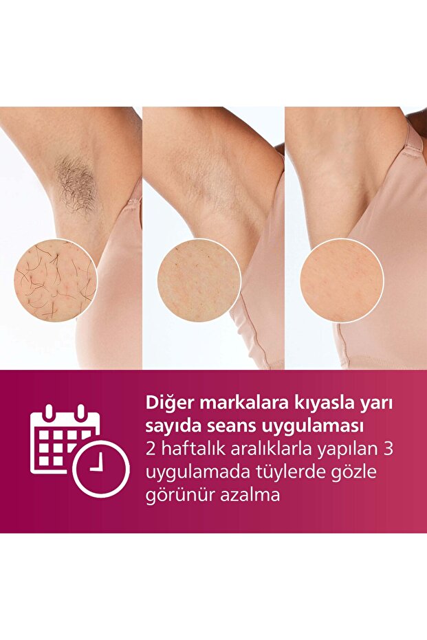 Lumea 7000 Serisi BRI921/00 IPL Tüy Alma, Tüy Kısaltıcı,Vücut ve Yüz için 2 Başlık, Çanta - 4