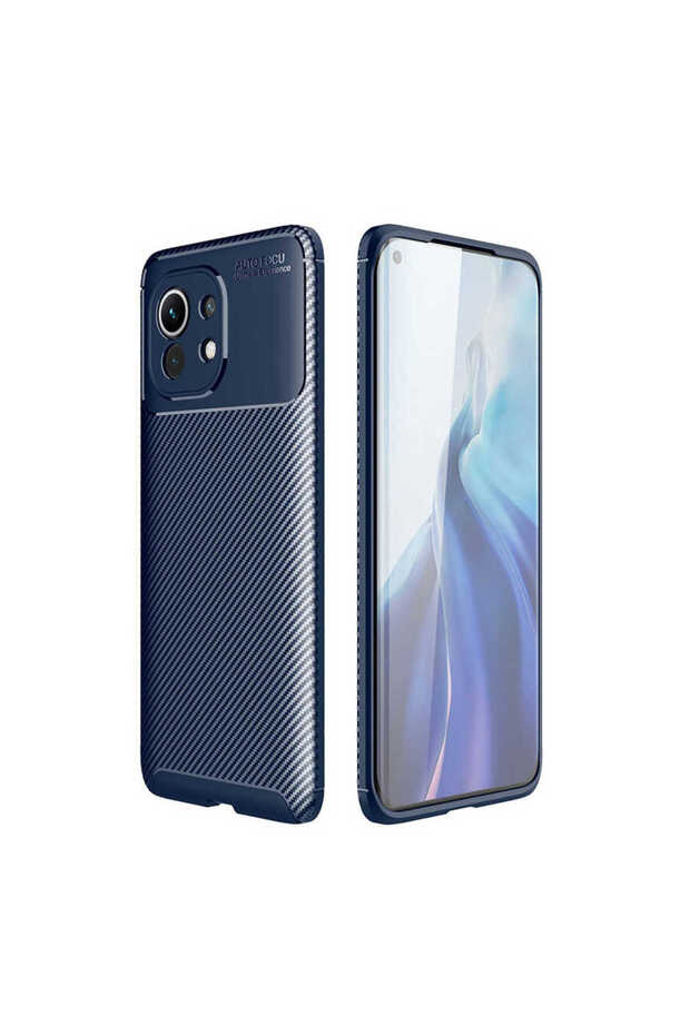 Xiaomi Mi 11 Case Carbon Fiber Look Ultra Thin Carbon Case