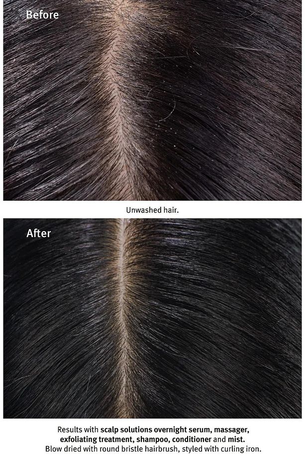 Scalp Solutions Saç Derisi Için Şampuan 1000ml - 5