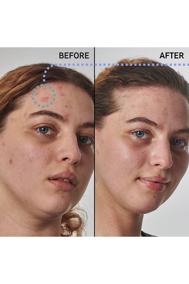 Dry and rough skin slution with 10% urea - Yüz Serumu - 1