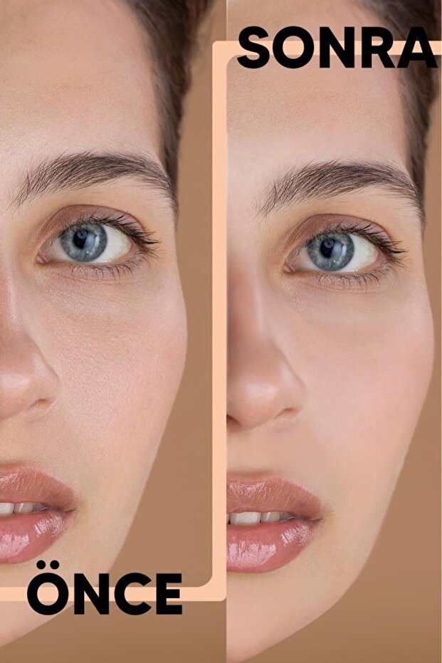 Likit Kapatıcı No:2 - 8