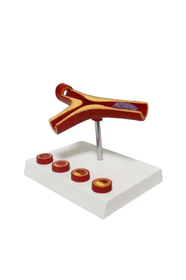 Damar Tıkanıklığı Model 46 - 2