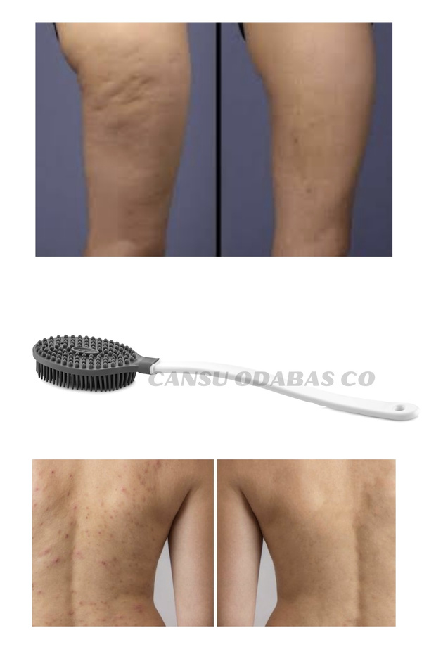 Bathroom Shower Brush - Back Acne and Miraculous Design