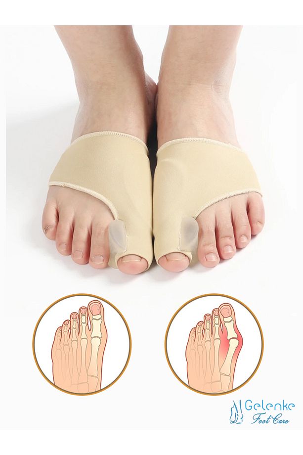 Baş Parmak Kemik Düzeltici 2li Set - Halluks Valgus - M - 1