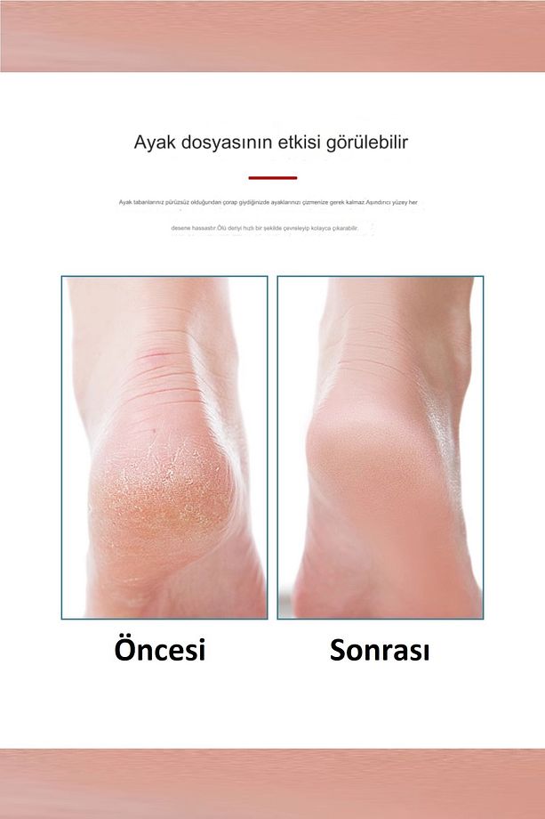 Kristal Ayak Topuk Törpüsü Yeni Ped Egg Ayak Bakım Rendesi Topuk Törpüsü - 4
