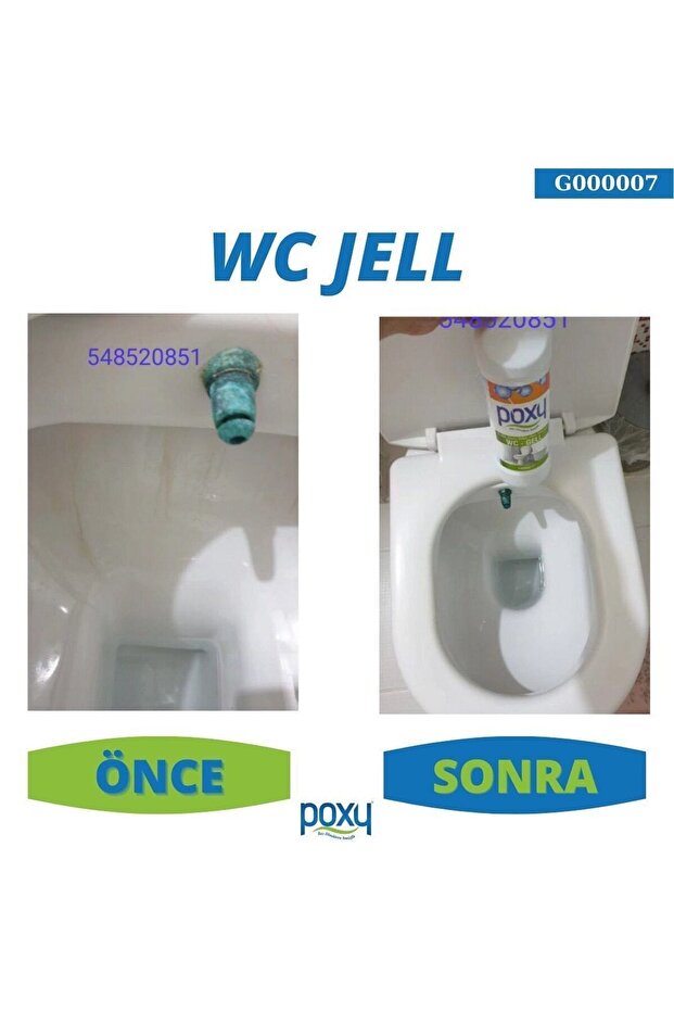 Tuvalet Temizleme 1 Lt Kireç, Üre Taşı Sararmış Lekeler, Tartar Ağır Kir, Pas ,su Yosun Izlerinide - 5