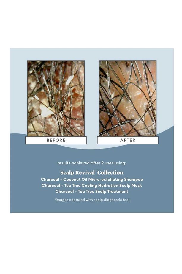 Scalp Revival Charcoal - Arındırıcı Şampuan 226ml - 4
