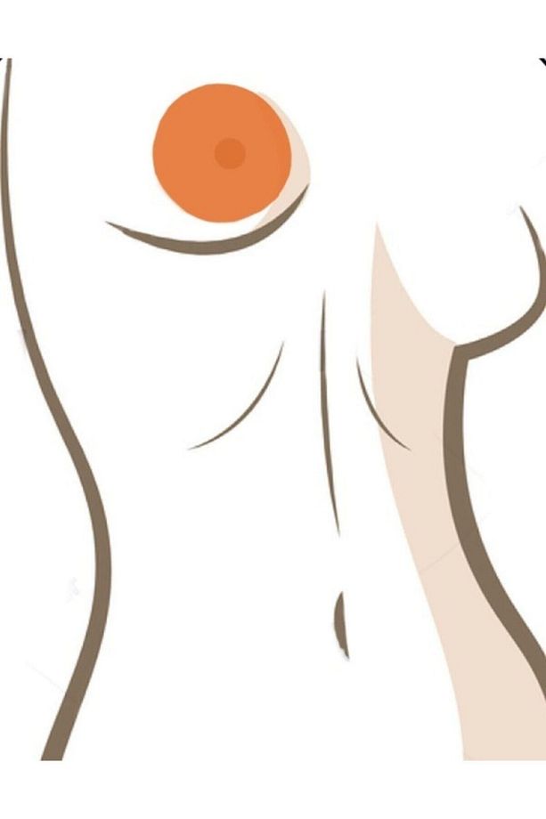 Areola Silikon Sheet (YAPIŞAN) - 2 Adet 7,8x2,0x0,1 Cm Meme Estetiği Sonrası - 3