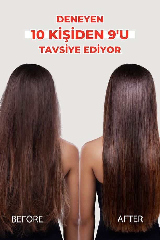 Forte Saç Dökülmesi Karşı Şampuan 300 ml -Kuru ve Normal Saçlar -3 Al 2 Öde  8699349130961 - 7