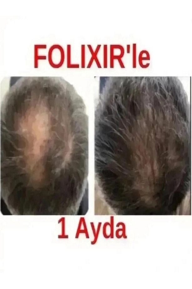 Elixir Saç Dökülmesine Karşı Mega Serum 150 ml - 4