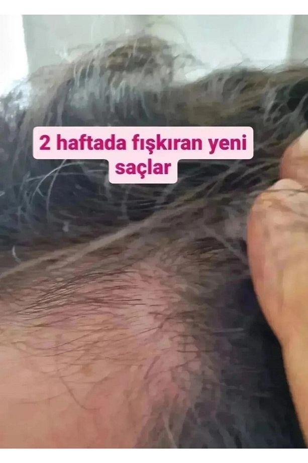 Elixir Saç Dökülmesine Karşı Mega Serum 150 ml - 6