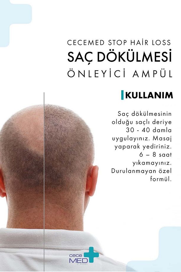 Saç Dökülmesi Önleyici Ampul - Stop Hair Loss Scalp Ampoules 5 X 7 Ml - 7