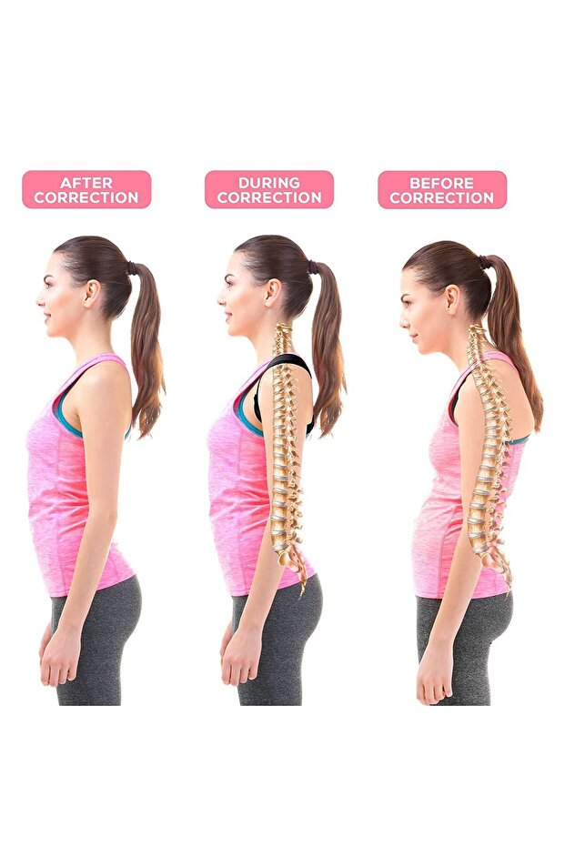 Exp Dik Duruş Korsesi - 5