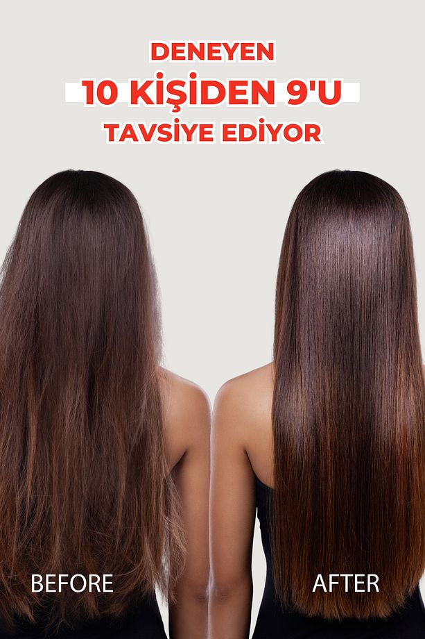 Hızlı Saç Uzatmaya Yardımcı Narlı Şampuan, Kırılan Saçlar Için Onarıcı Bakım 150ml - 4