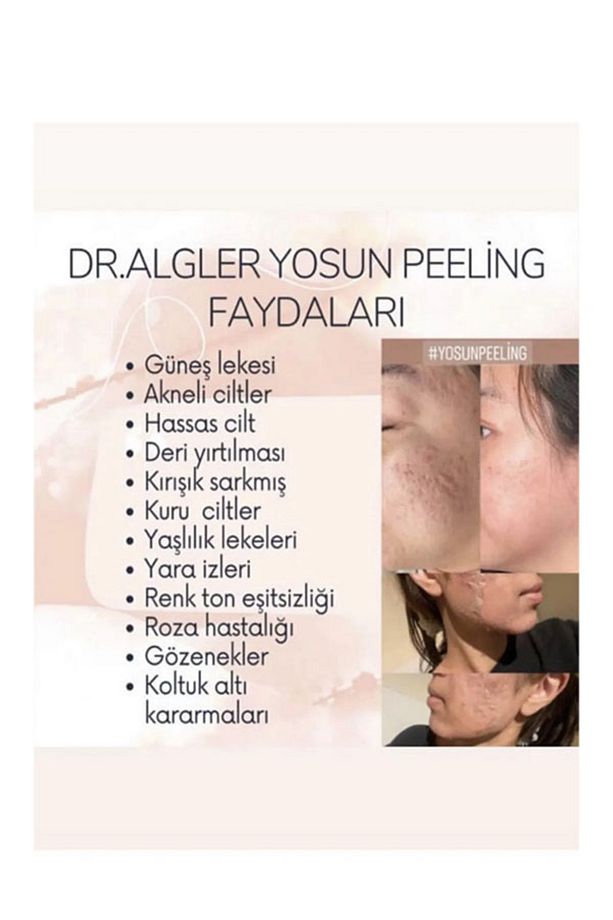 Dr.Algler Profesyonel Yosun Peeling 5 Uygulama Set - 3