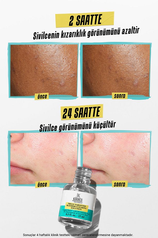 Truly Targeted Blemish-clearing Solution - Sivilce Karşıtı Serum 15 ml - 5