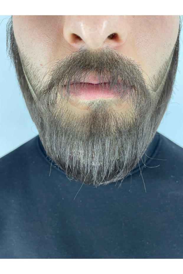 TAKMA SAKAL BIYIK - 6