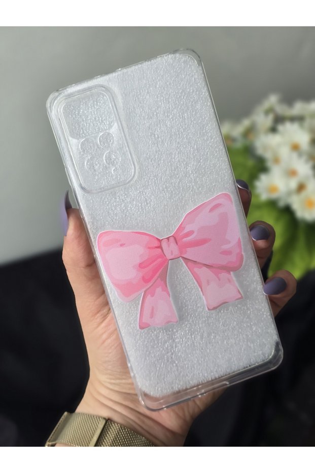 Xiaomi Redmi Note 11S - Note 11 Compatible Printed Transparent Phone Case